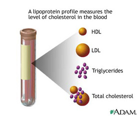 cholesterol screening